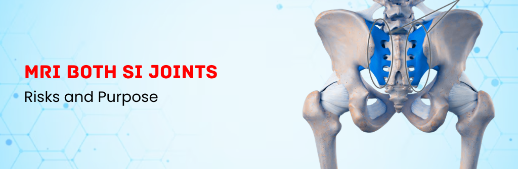 What are the Risks and Purpose of MRI BOTH SI Joints